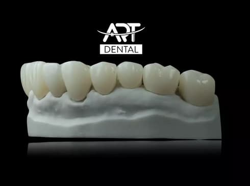 Slider image (7) Art Dental Care